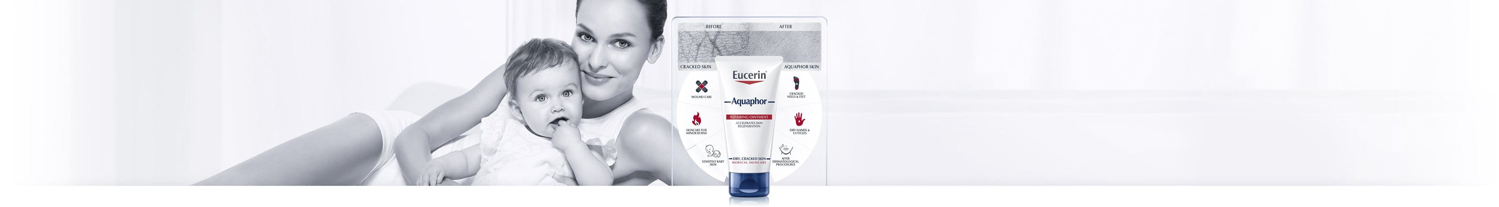 Aquaphor tepalas pažeistai odai